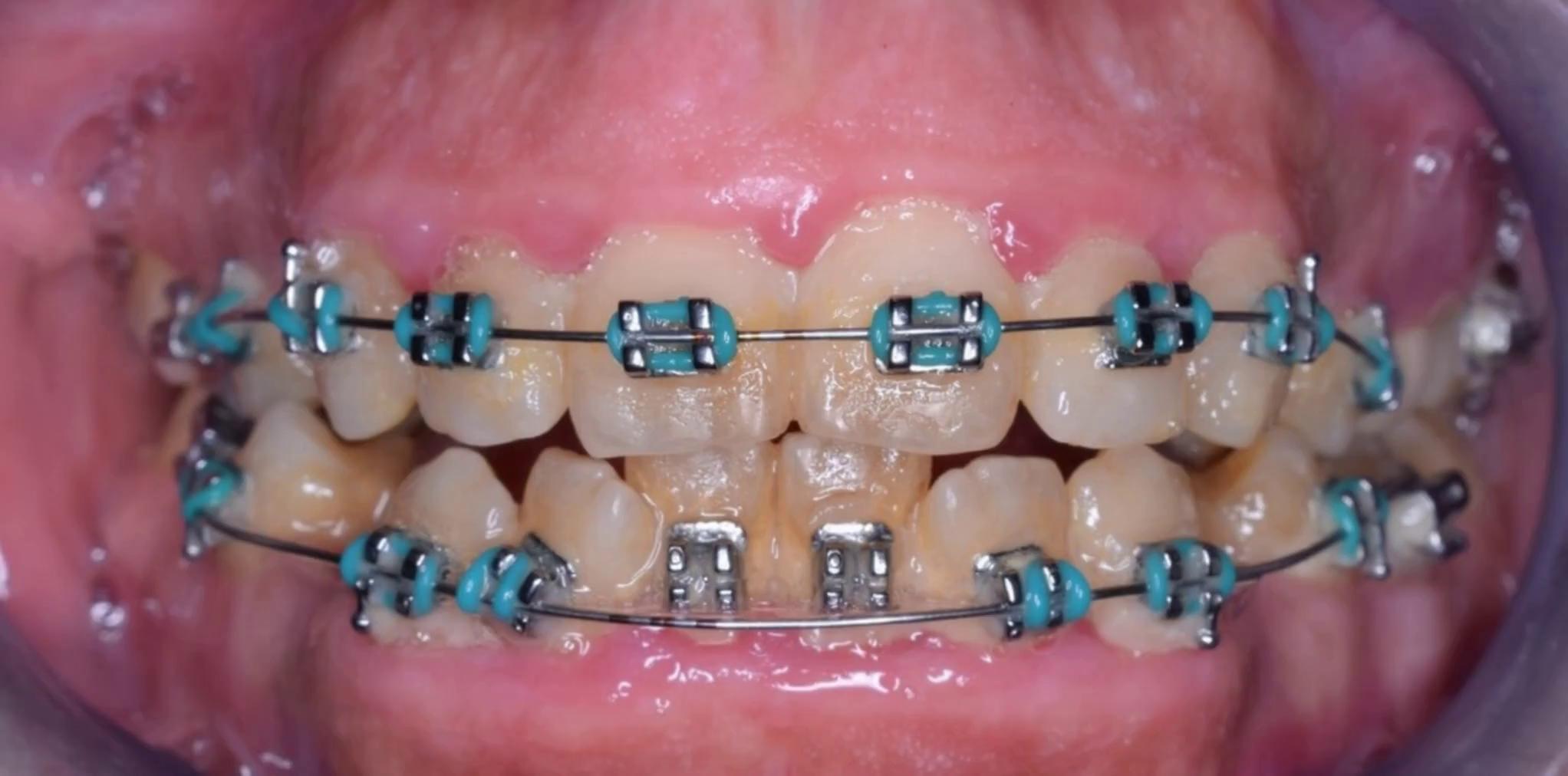 Prompt: morph transition make it smooth and realstic without any change in the color or light keep everything natural