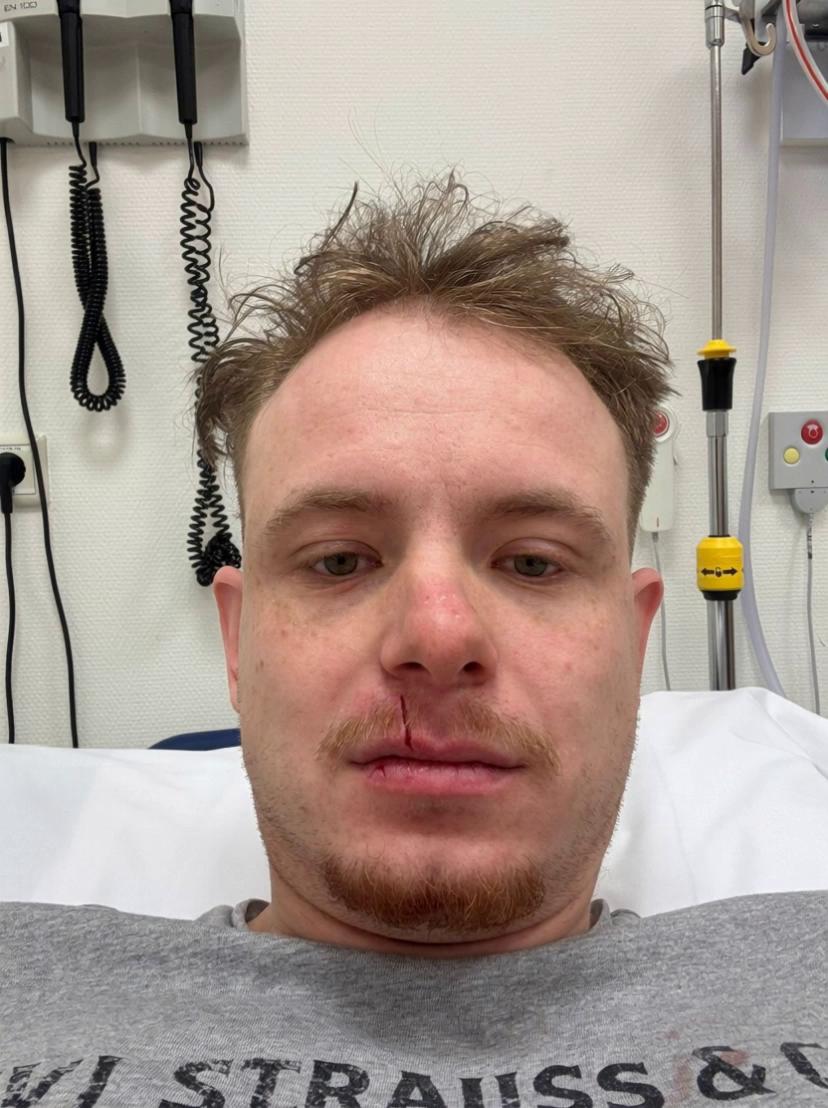 Prompt: Please make sure a cat is sitting on his head removing his hairline on the side of his head, inch by inch