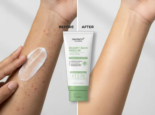Prompt: In the image reference, please add more visible strawberry skin on the hand of the model, in the before section of the image. Spread out the lotion to make it look a litle more aesthetic but still natural. On the right, in the after section, the skin should be smooth with no strawberry skin and slightly brighter.
