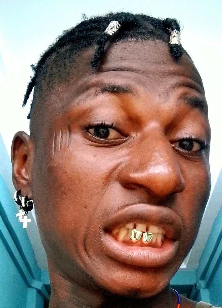 Prompt: gold teeth grillz gold 