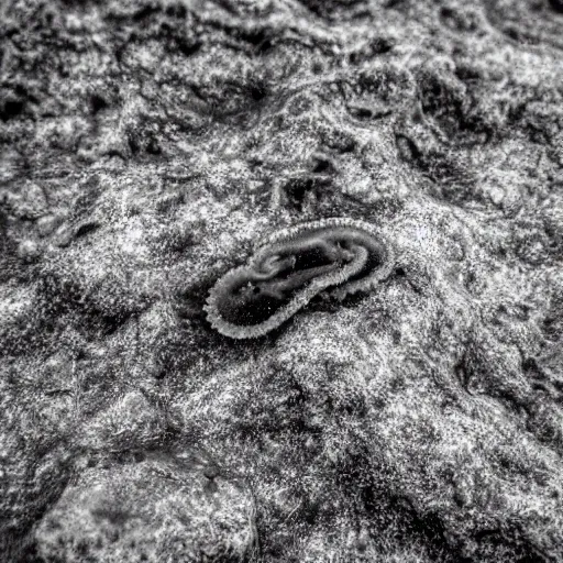 Image similar to a grainy photo of a mysterious cnidarian in the tide pools at a foggy beach