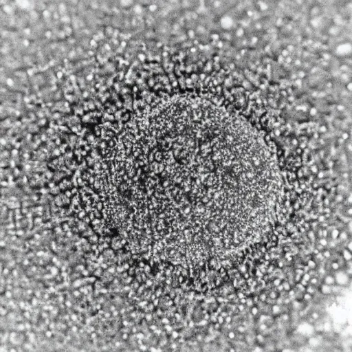 Image similar to electron microscope photograph of a nanomachine