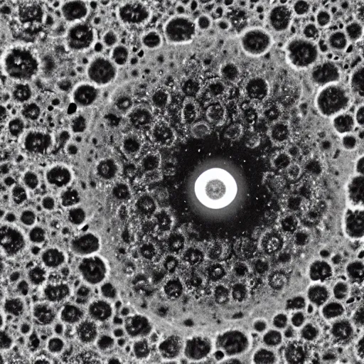 Prompt: electron microscope photograph of a virus smiling