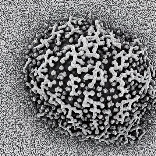 Image similar to electron microscope image of Covid-19 virus