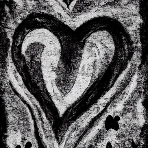 Prompt: The Ink Black Heart 